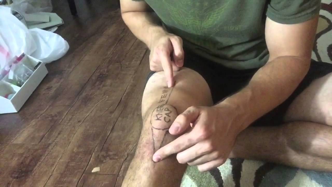 Tibial Internal Rotation and knee pain in athletes  - Sports Physical Therapy Charlotte, NC