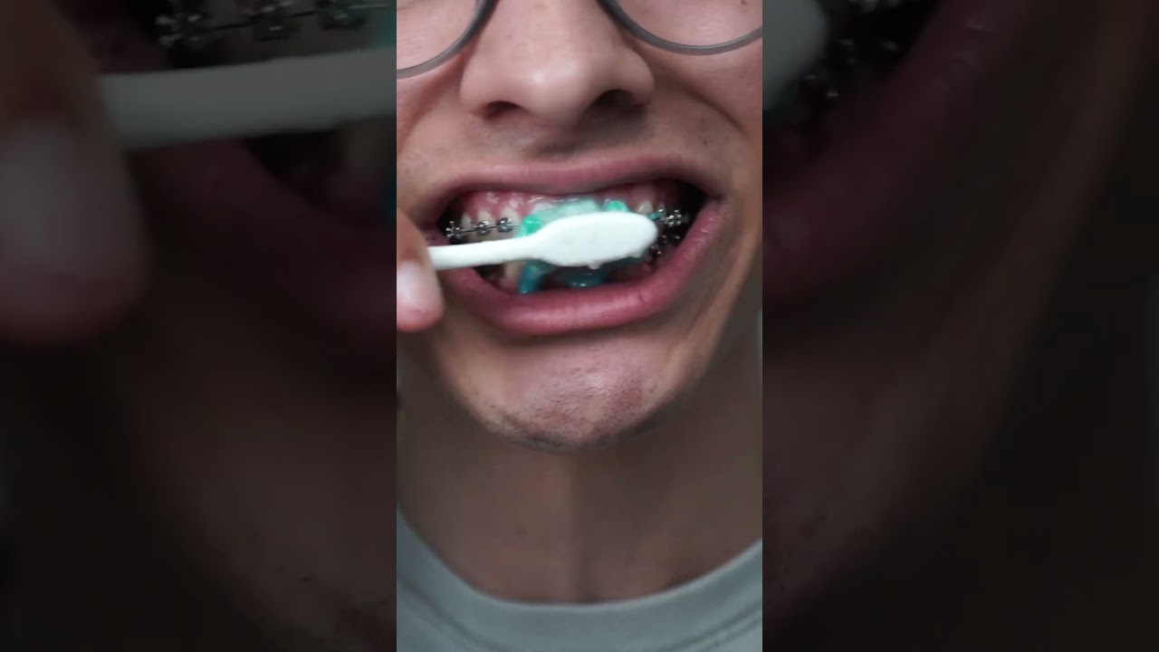 the toothbrush for braces