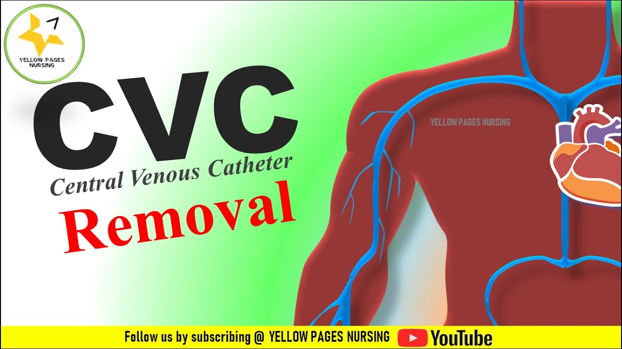 CVC Removal | Central Venous catheter removal steps |CVC Removal made easy