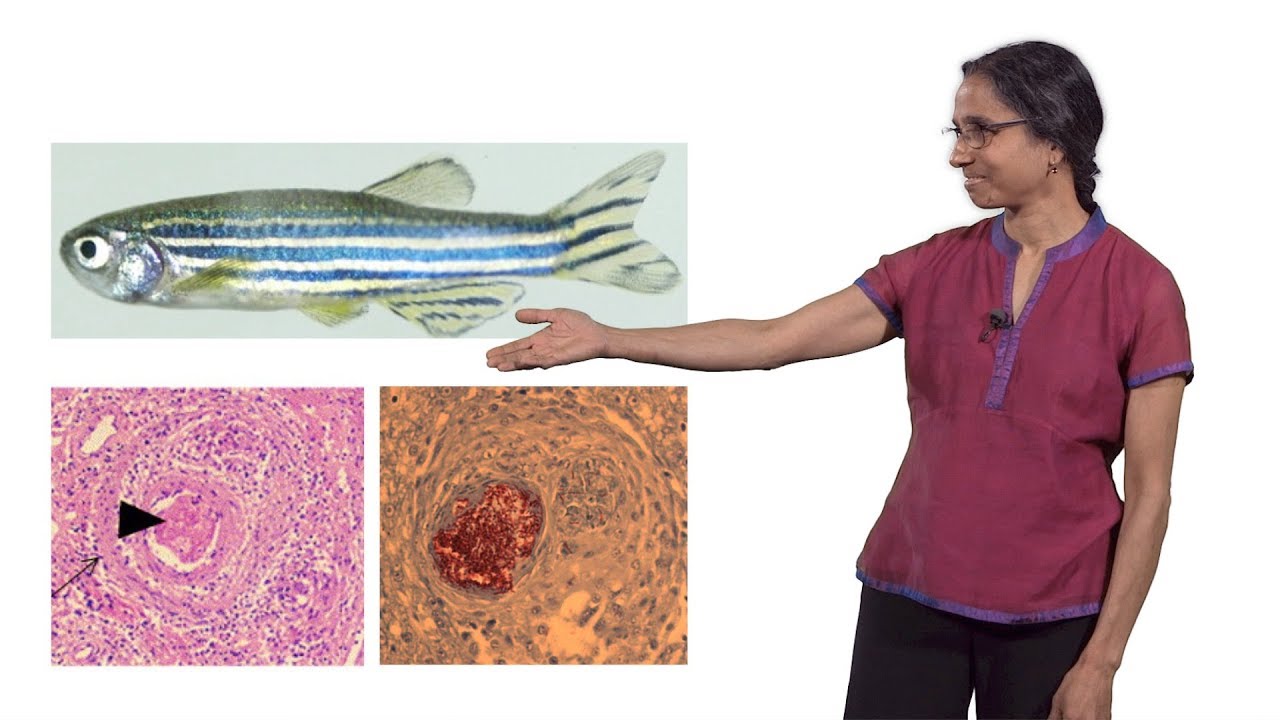 Lalita Ramakrishnan (Cambridge) 2: The Troublesome Tubercle in Tuberculosis