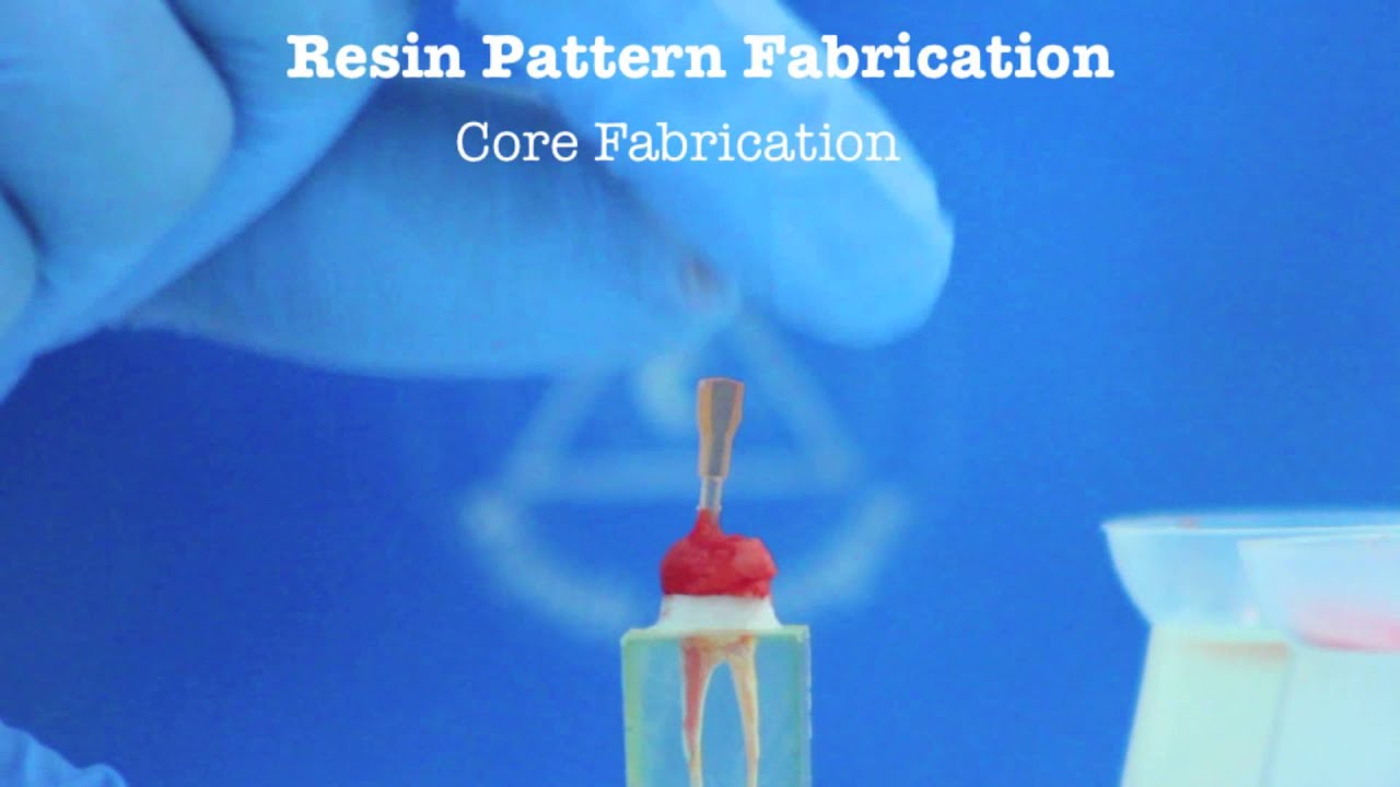 CUSTOM-MADE CASTED POST AND CORE