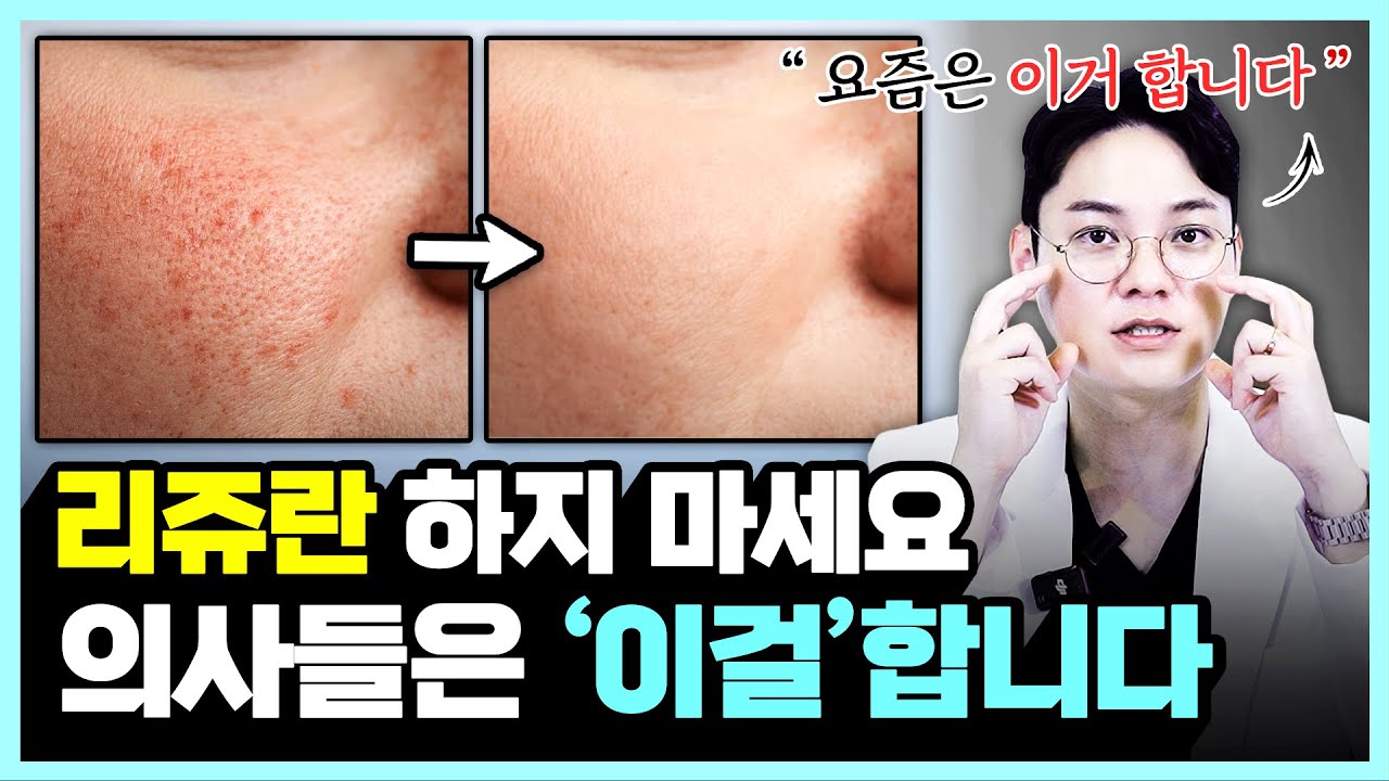 설마 아직도 리쥬란 찾고 계신건 아니시죠?ㅣ요즘 의사들은 ‘리바이브’를 찾습니다.ㅣ40대 동안 의사가 알려주는 리바이브의 모든 것