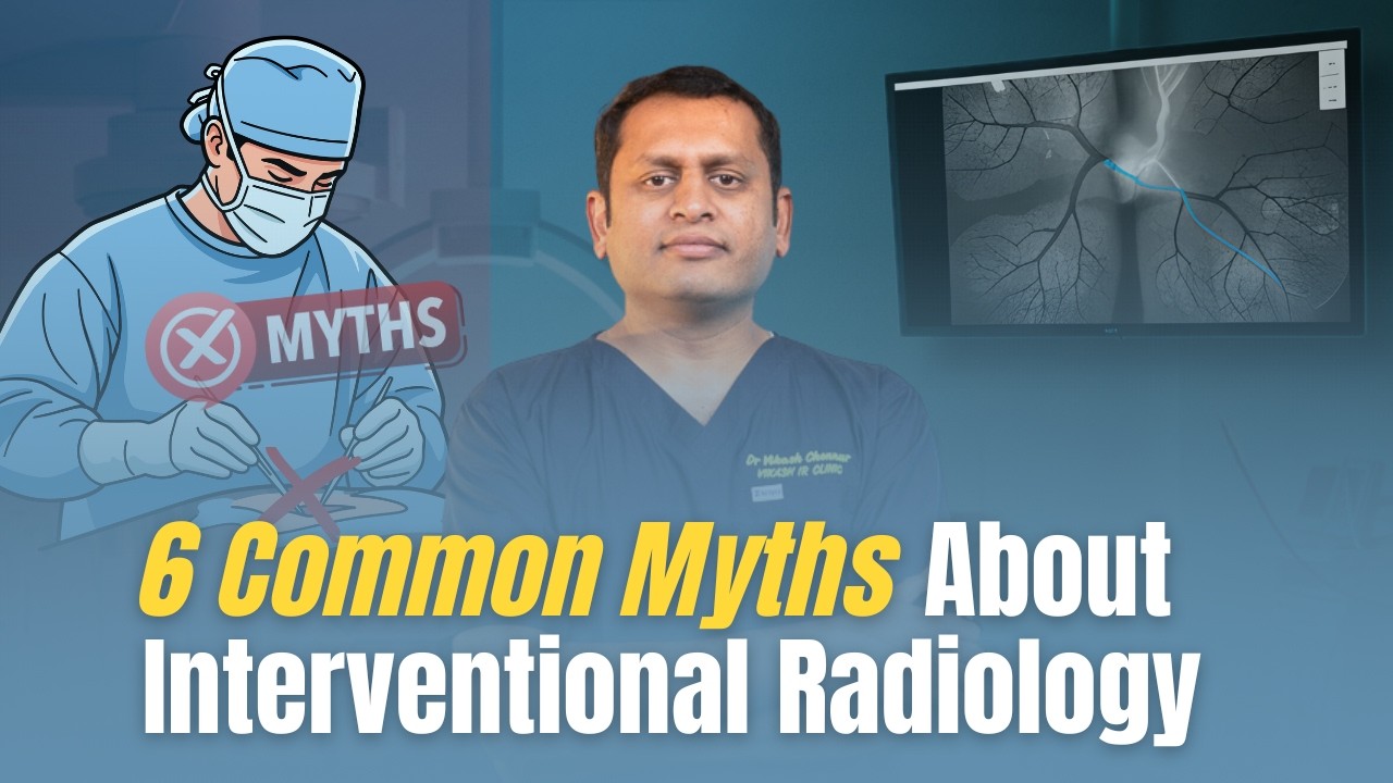 6 Myths About Interventional Radiology You Need to Stop Believing #interventionalradiology