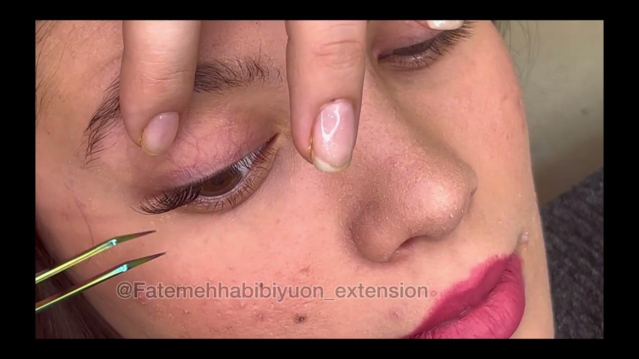 |آموزش کاشت هیدن مدل کیم|کاشت مژه