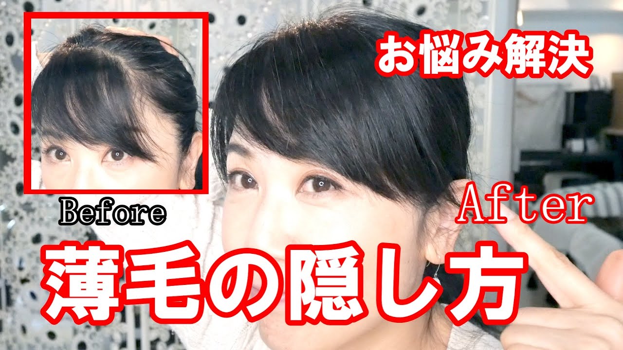 【40代50代】薄毛のかくし技｜薄毛対策｜お悩み解決