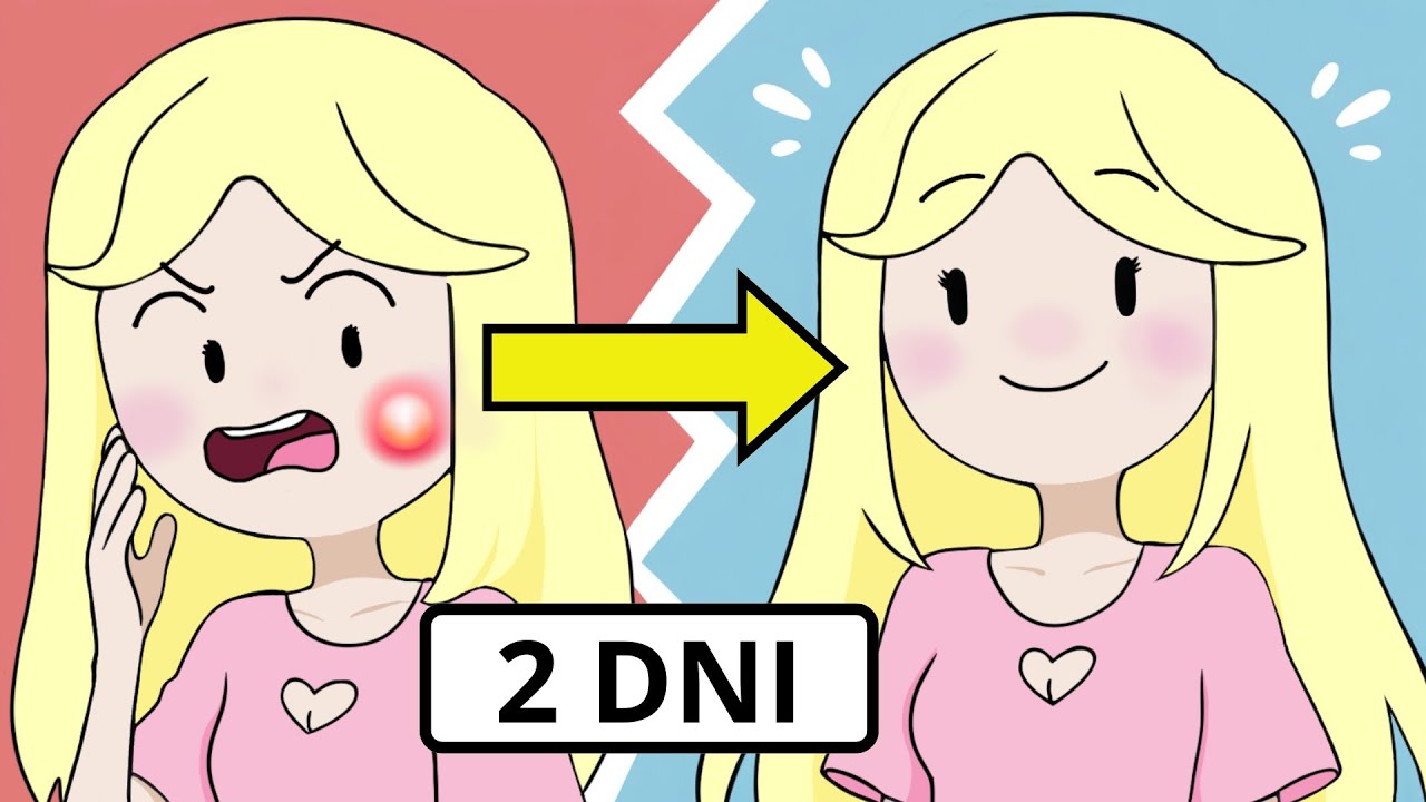 JAK POZBYĆ SIĘ PODSK&Oacute;RNEGO PRYSZCZA W 2 DNI? 🌋🌋🌋