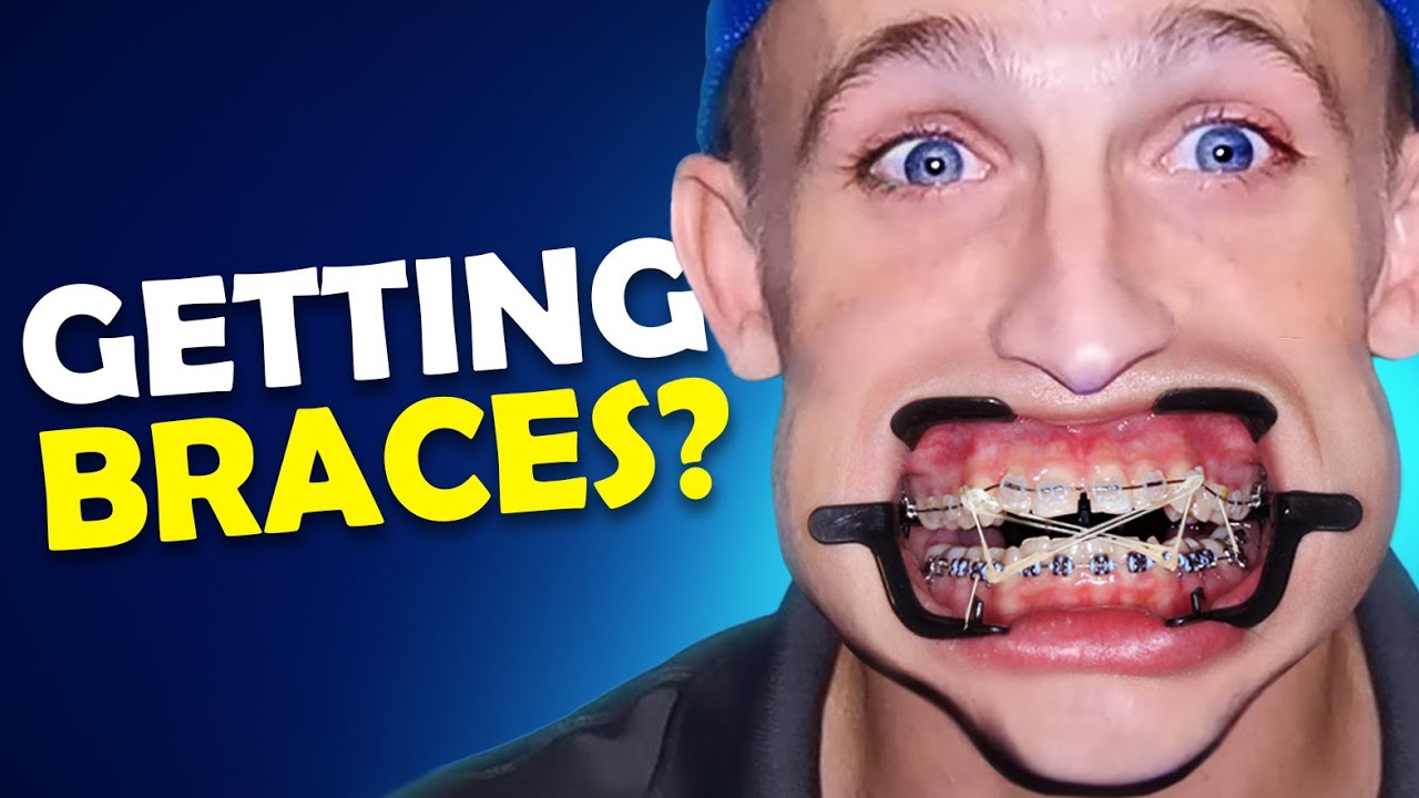 Orthodontist Shares 4 BRUTAL FACTS About Braces | Real Talk with McKinney Orthodontics