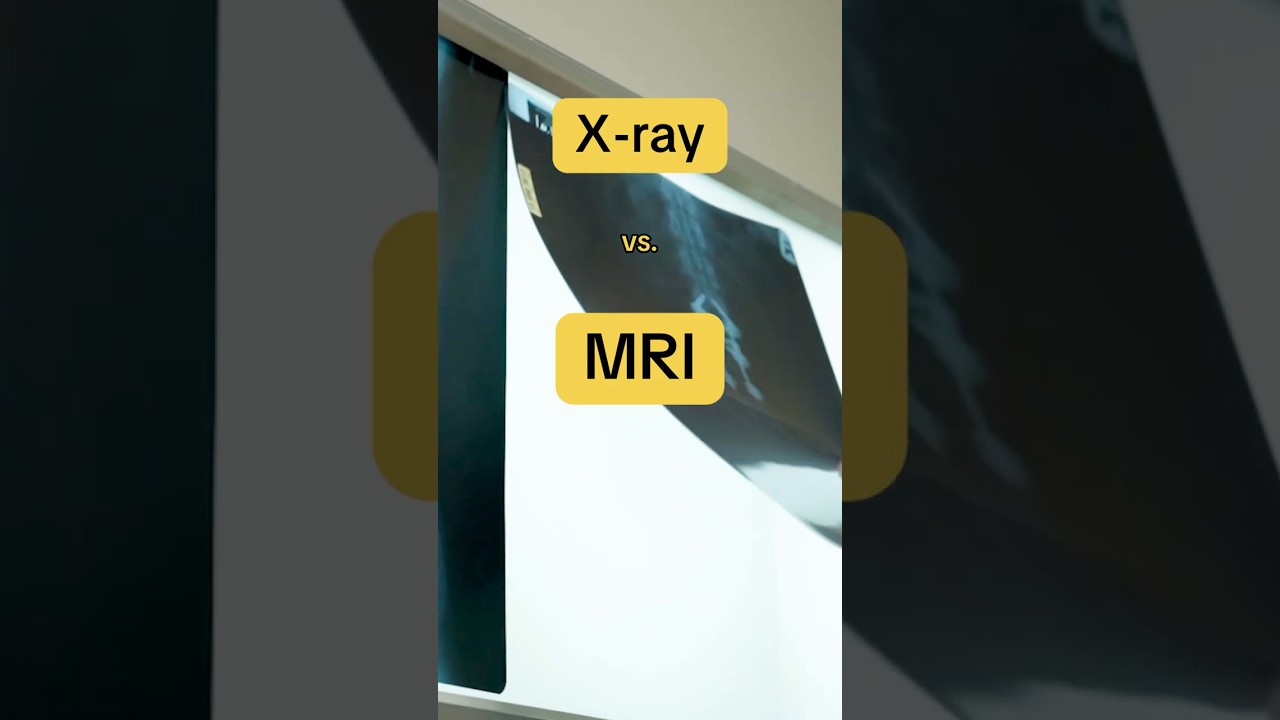 🩻 X-Ray vs. MRI 🧲