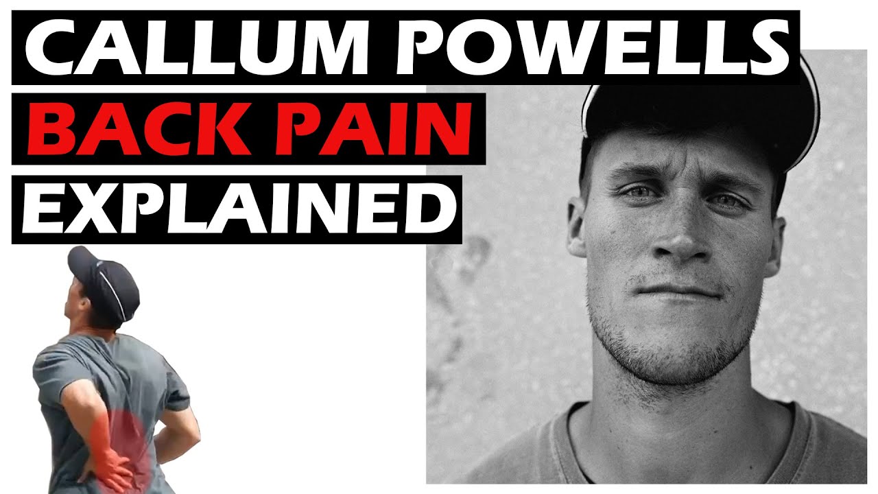 Callum Powell's back pain explained [Storror athlete analysis 4]