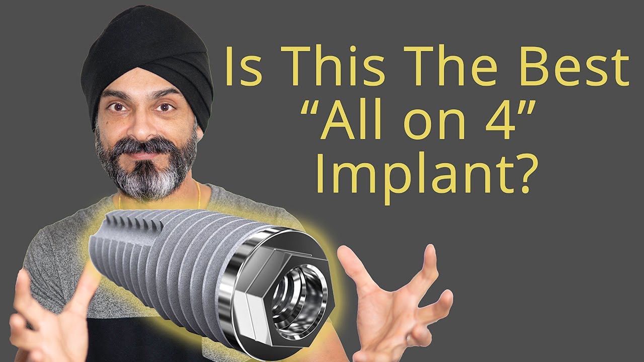 The Best All on 4 Dental Implant for a Full Set of Teeth?