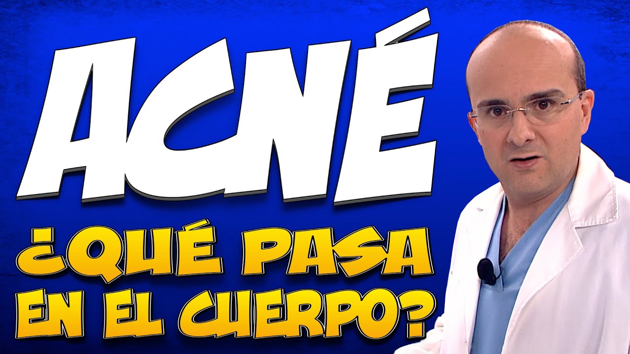 ACNÉ - ¿Qué pasa en el cuerpo de quienes lo padecen?