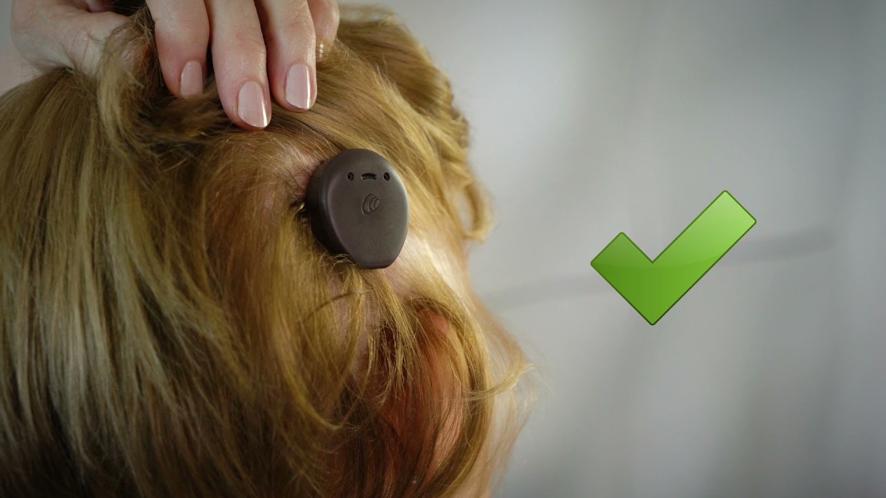 How to place the Nucleus® Kanso®  2 Sound Processor correctly
