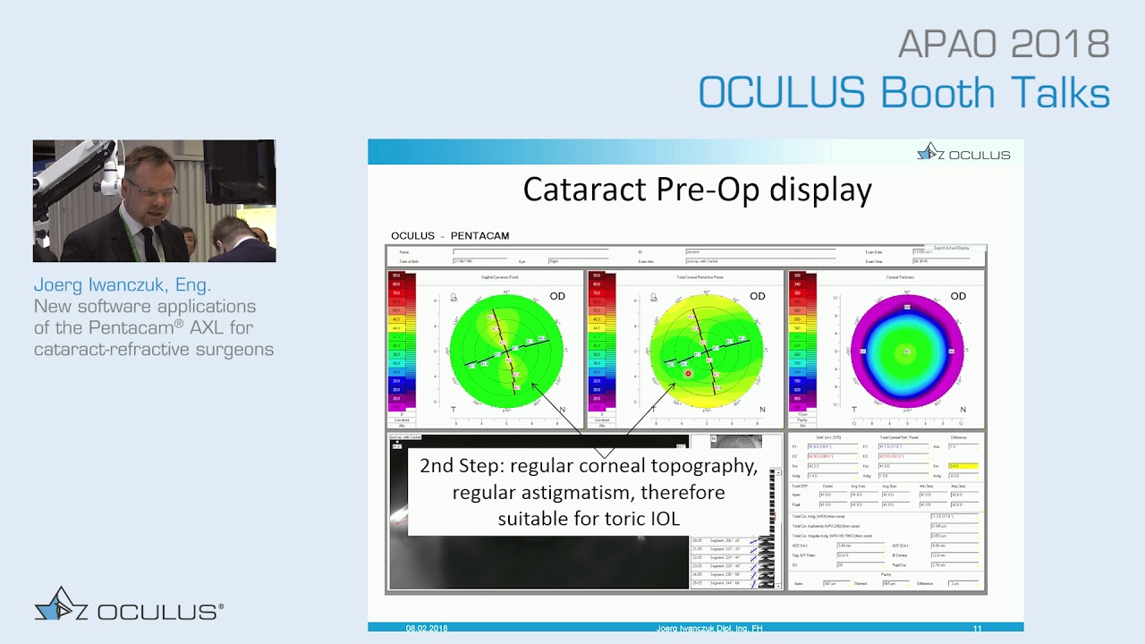 J. Iwanczuk, Eng.: New software applications of the Pentacam&reg; AXL for cataract-refractive surgeons