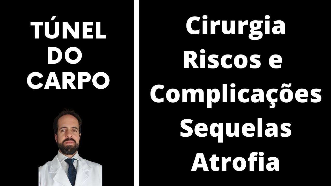 9 respostas sobre a Cirurgia de Túnel do Carpo