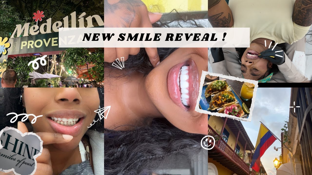 COME WITH ME TO GET MY TEETH DONE IN COLOMBIA + NEW SMILE REVEAL | SHINE SMILES !!!