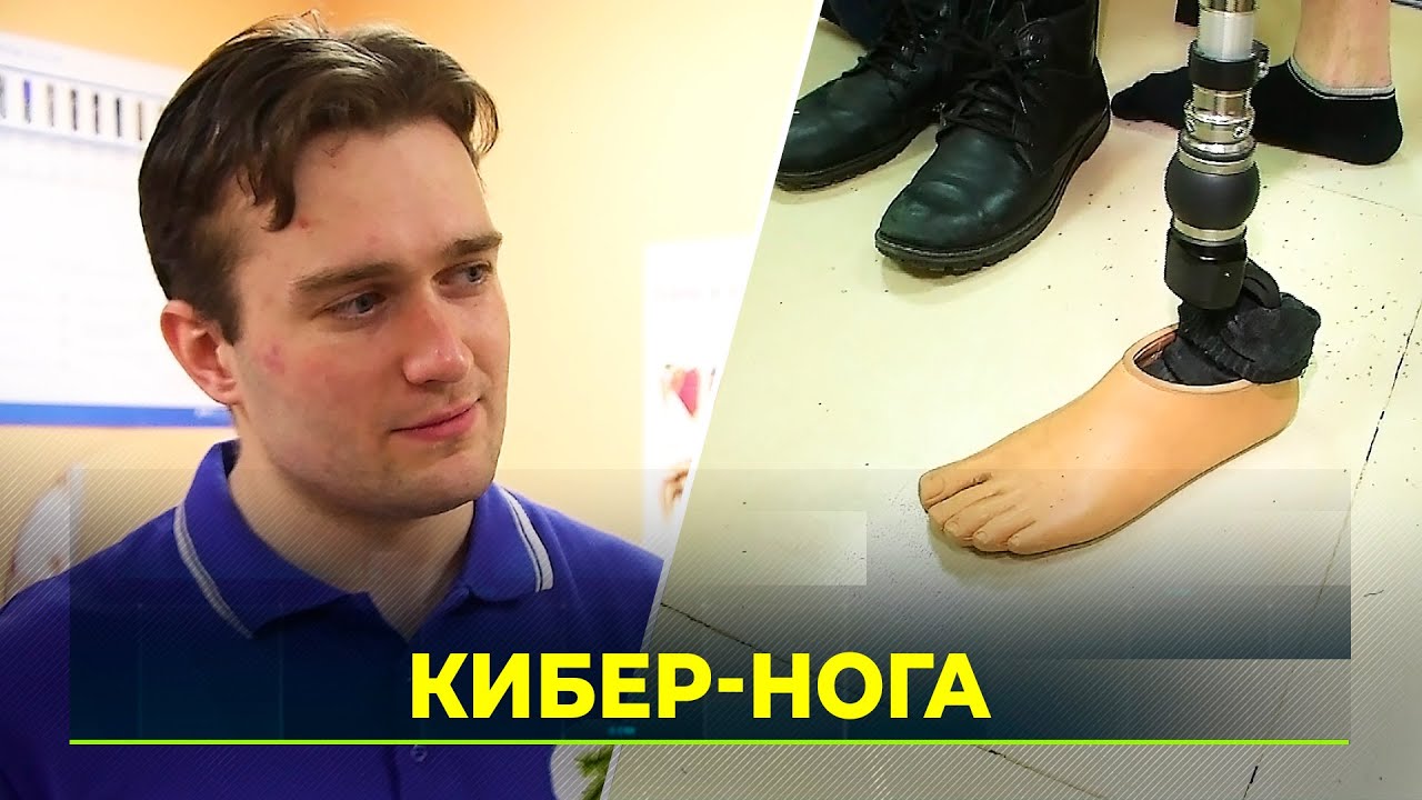 В Салехарде вручили первый бионический протез с микропроцессорным управлением