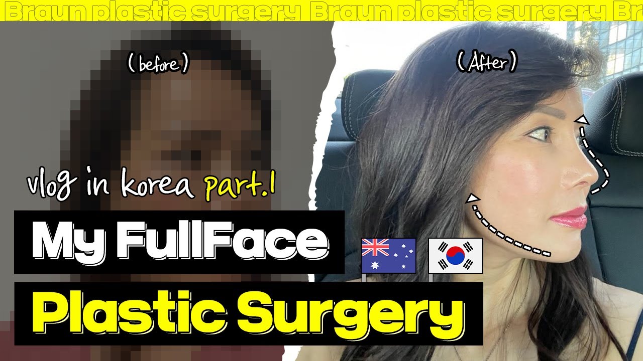 Complete Korean Plastic surgery Makeover│Middle aged woman finds her newself (Part1)
