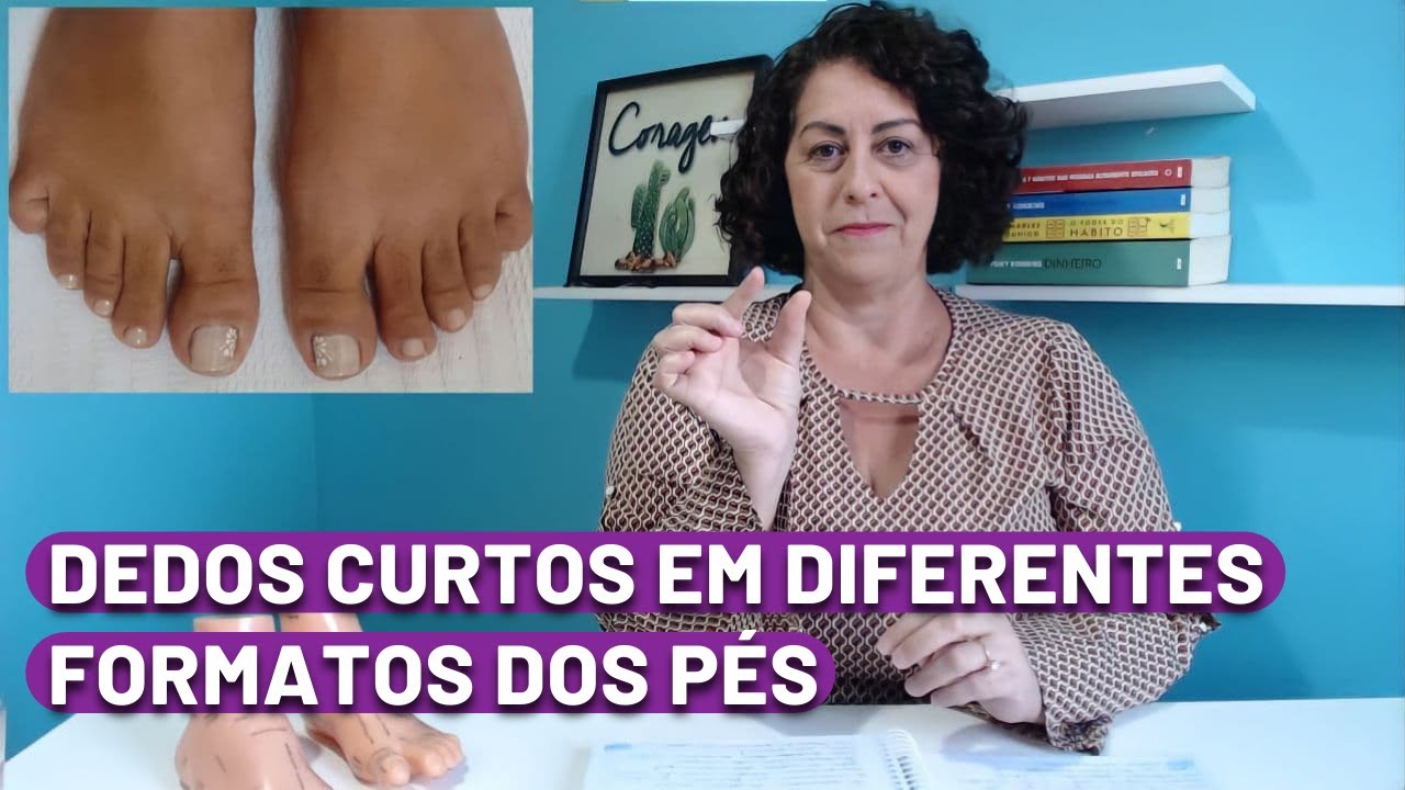 DEDOS CURTOS EM DIFERENTES FORMATOS DOS PÉS