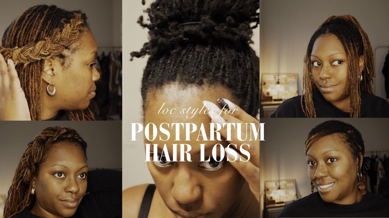 Ways To Style Your Locs After Loss| Postpartum Hair Loss| Microloc Styles