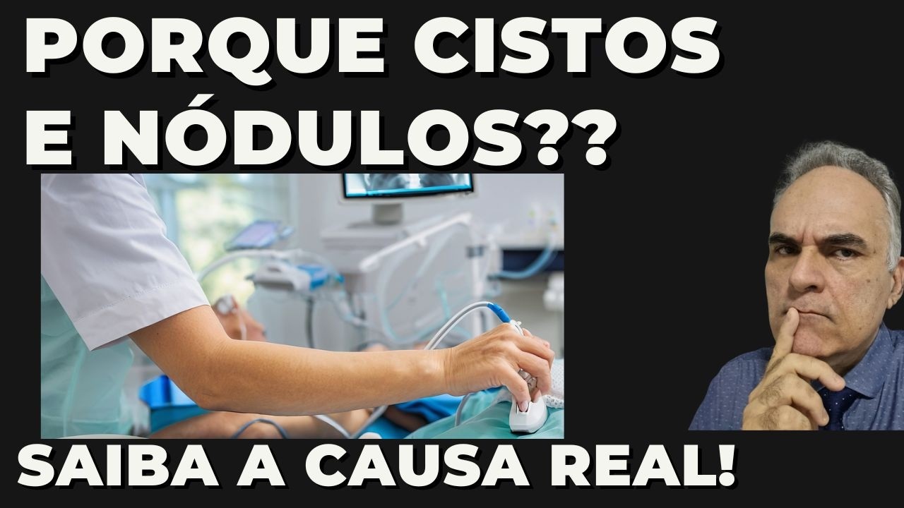 Porque você tem cistos e nódulos! Saiba a verdade
