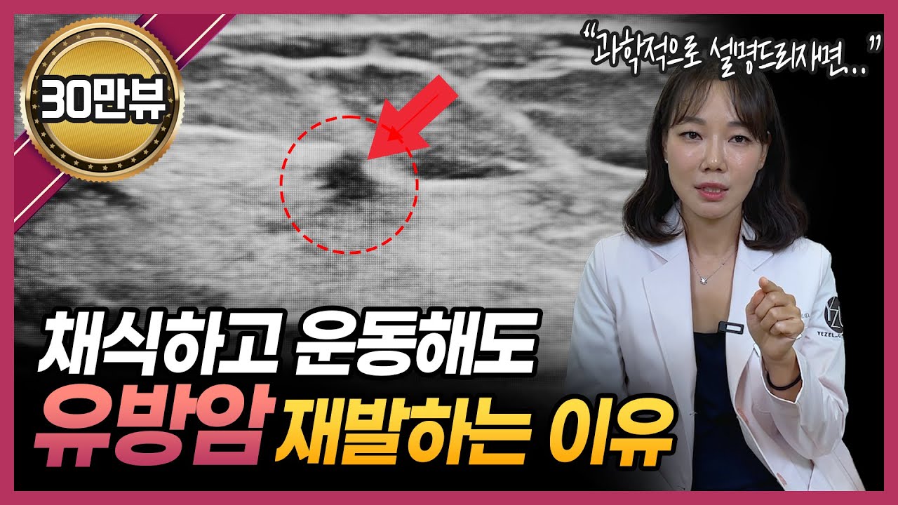 과학적으로 밝혀진 유방암 재발의 이유는 ‘이것’ 때문입니다!