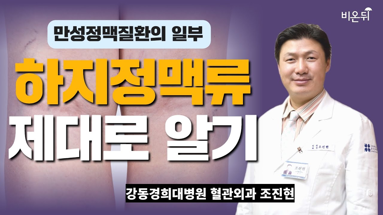 만성정맥질환의 일부 하지정맥류, 제대로 알자 (강동경희대병원 혈관외과 조진현)