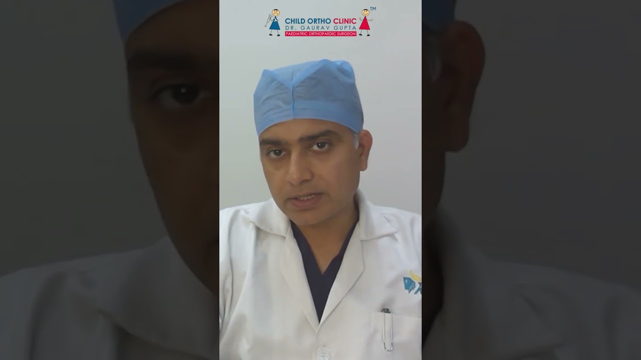 Is TA tenotomy necessary in all clubfoot cases?
