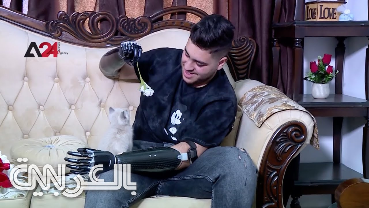 فتى الزرقاء يعود لحياته الطبيعية بعد حصوله على أطراف صناعية