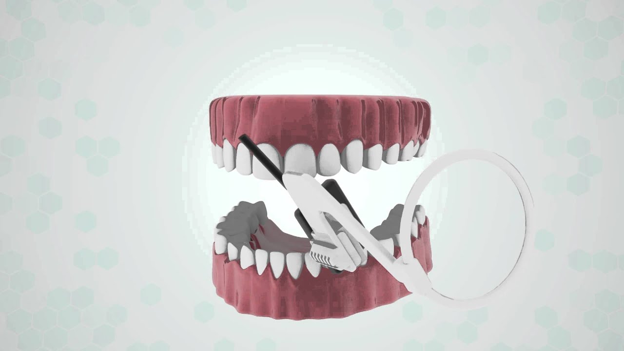 Digital X-Ray Positioner