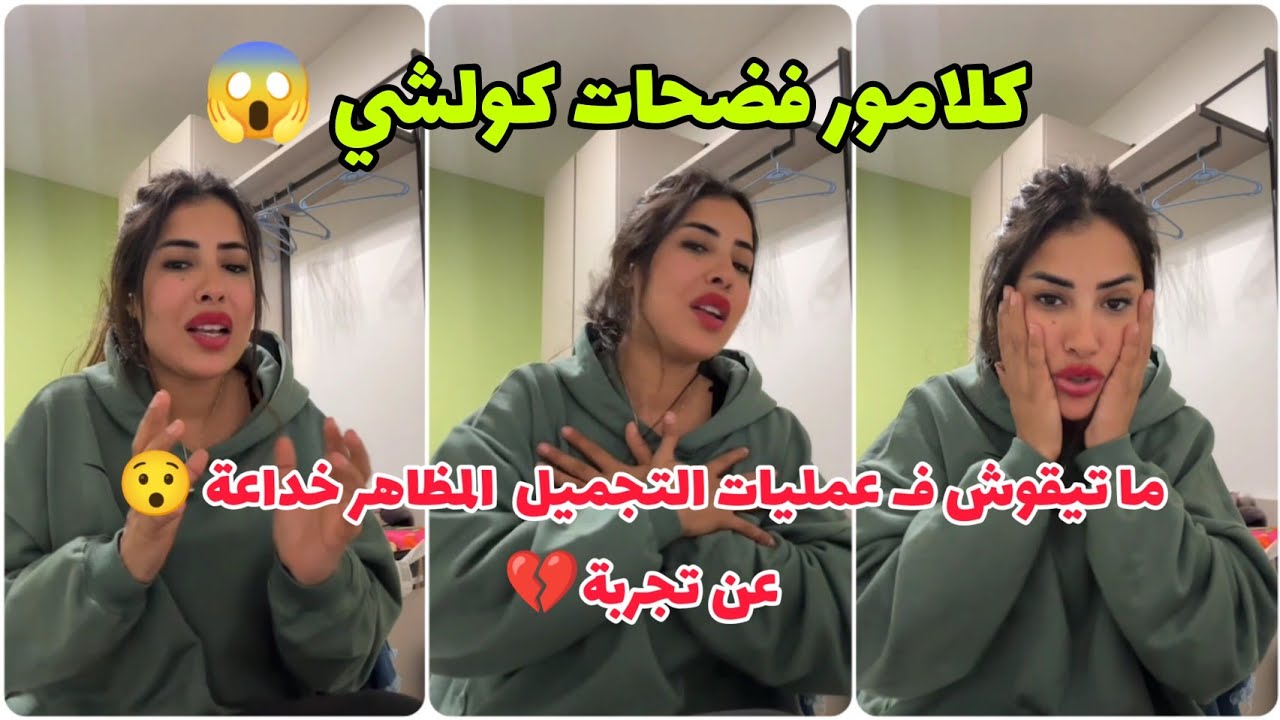 كلامور قالت كولشي💔حقيقة و مخاطر عمليات التجميل 😯 ما تغركومش المظاهر ⚠️ عن تجربة 👌 soukaina Glamour