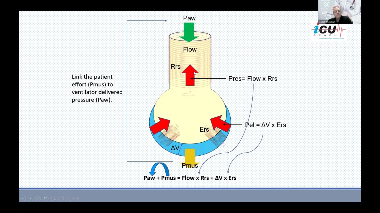 Proportional Pressure Support & PAV+