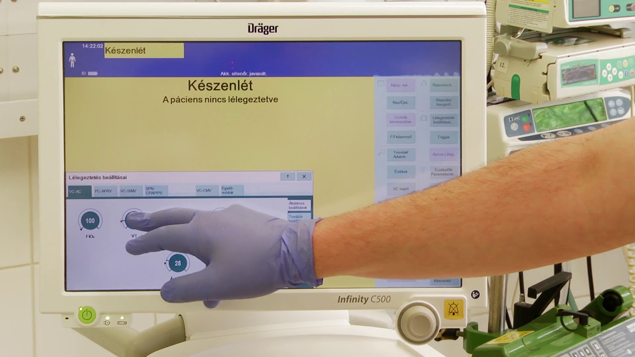 Lélegeztetőgép beállítása, lélegeztetés indítása