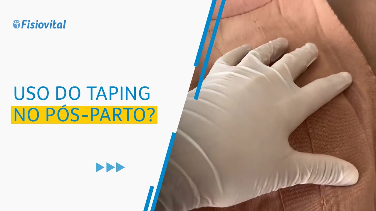 Como funciona o uso do taping no pós-parto? | Fisiovital