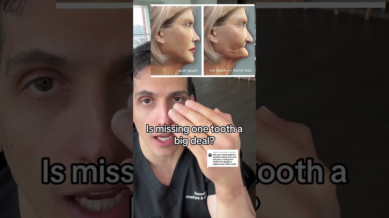 Is missing one tooth a big deal