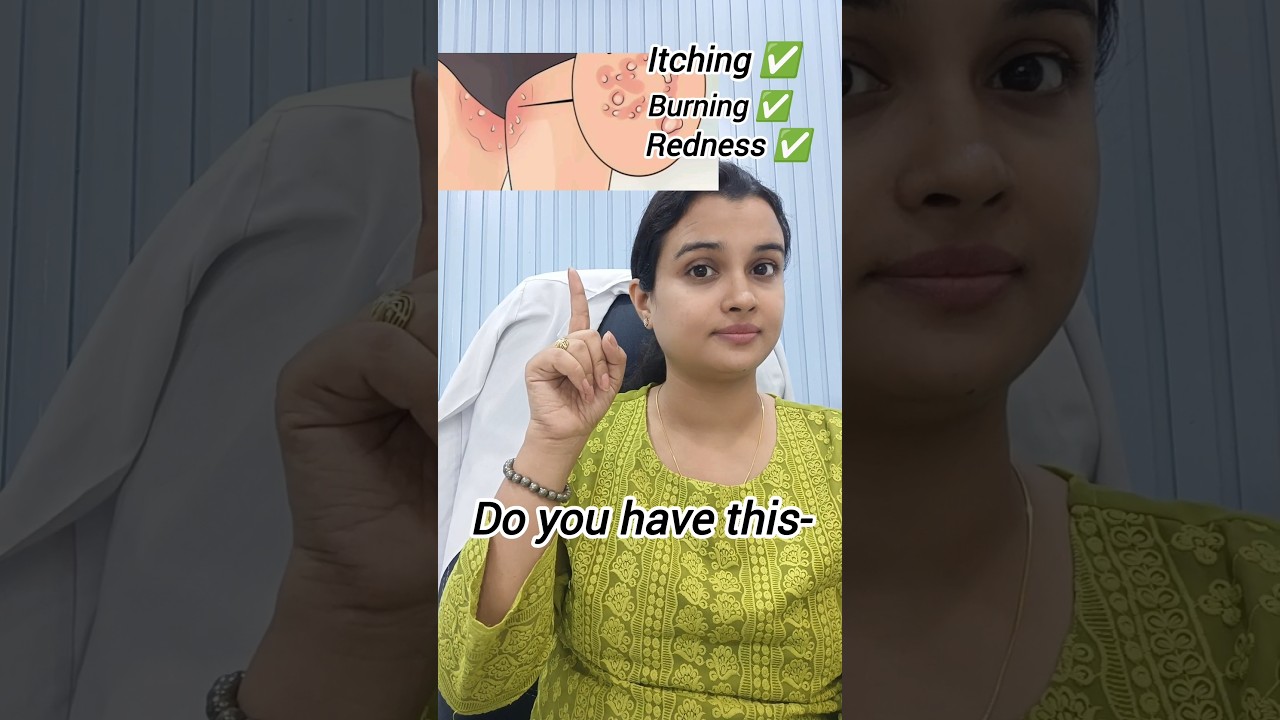 Ringworm creams#ringworm #fungalinfection#skincare#shorts #short#trending#ytshorts#youtubeshorts