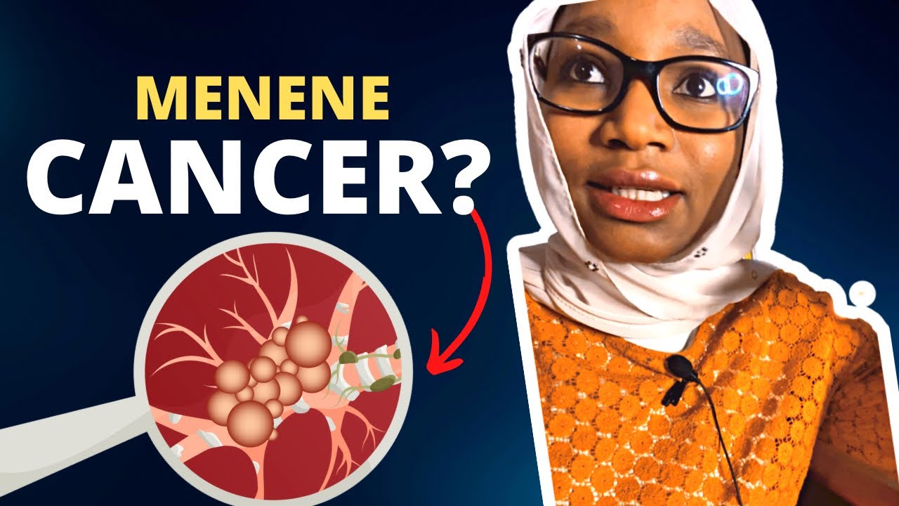 Menene cancer? Meke jawowa kuma ya ake kiyaye wa?