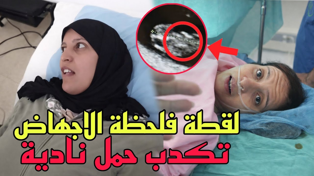 لحظة إجهاض نادية فضحات فلقطة كدبة الحمل دياله😨صوروها من الكلينيك بلا متشوفهم بعد خروجه 