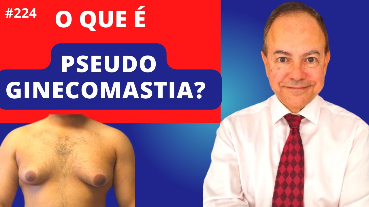 O que &eacute; PseudoGinecomastia [Dr. Jacintho - Cirurgi&atilde;o Pl&aacute;stico]