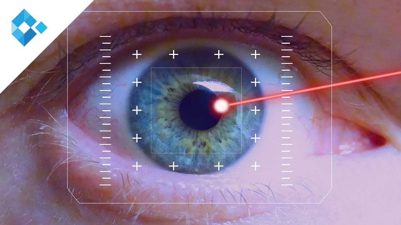 Im Trend: Augenlasern statt Brillen tragen | Dr. Abri