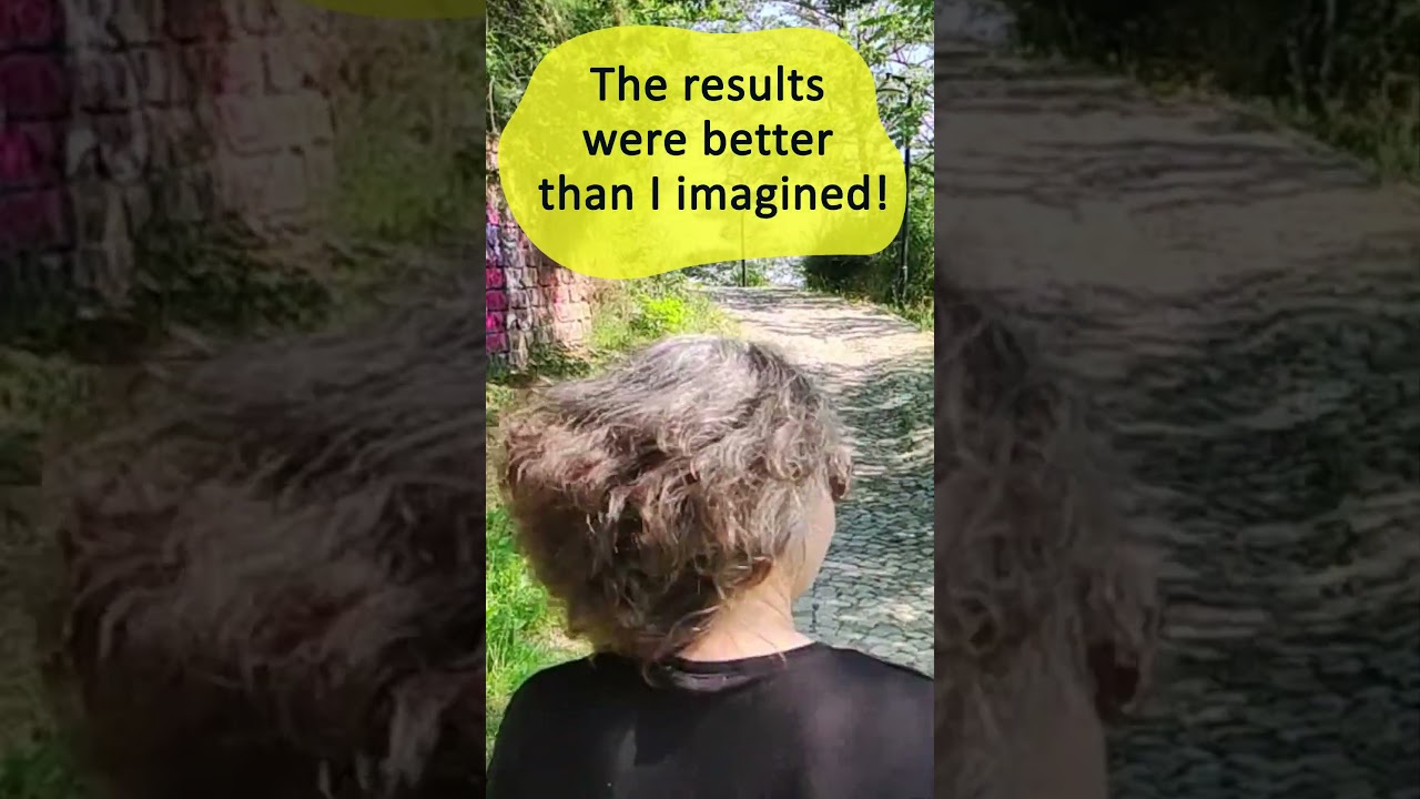 My hair has never been this thick before. The results were better than I imagined! Read below