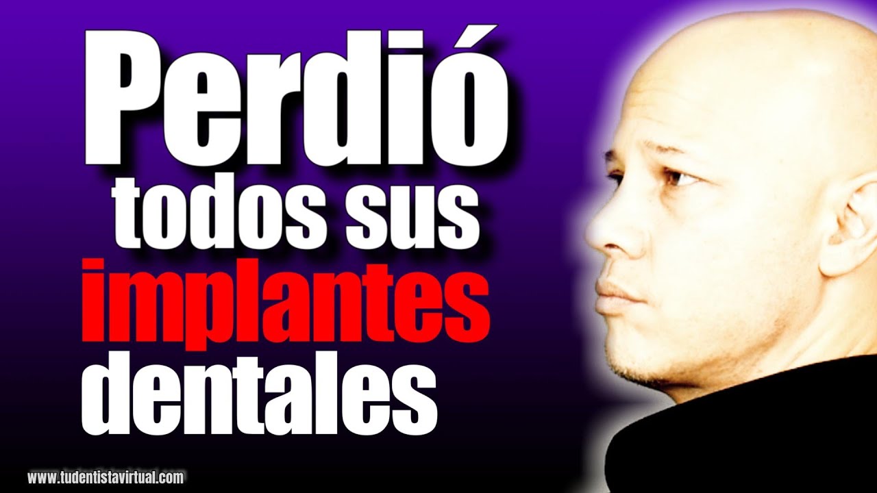 El ERROR que TODOS COMETEN al COLOCARSE IMPLANTES DENTALES