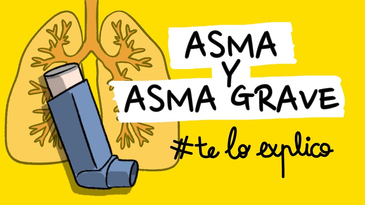 ASMA Y ASMA GRAVE | 