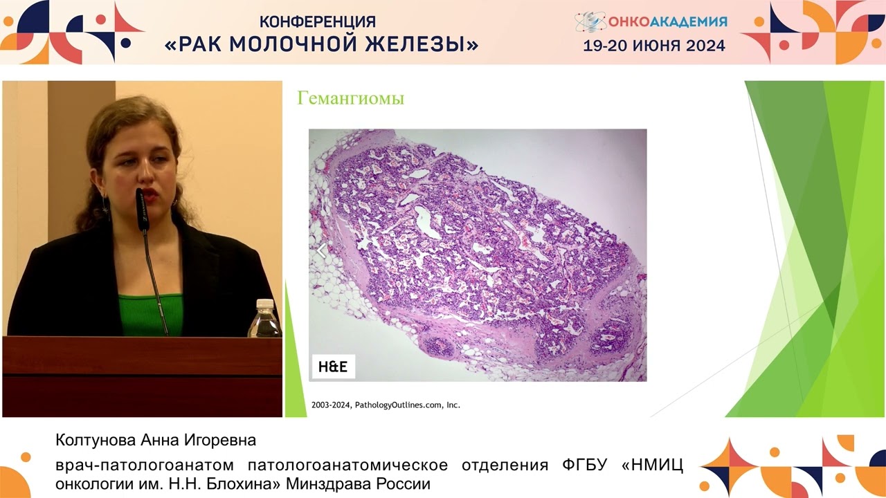 Клинико-морфологические особенности ангиосарком молочной железы, трудности диагностики.