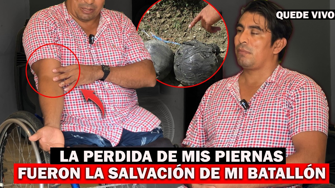 LA PERDIDA DE MIS PIERNAS 😔FUERON LA SALVACI&Oacute;N DE MI BATALL&Oacute;N