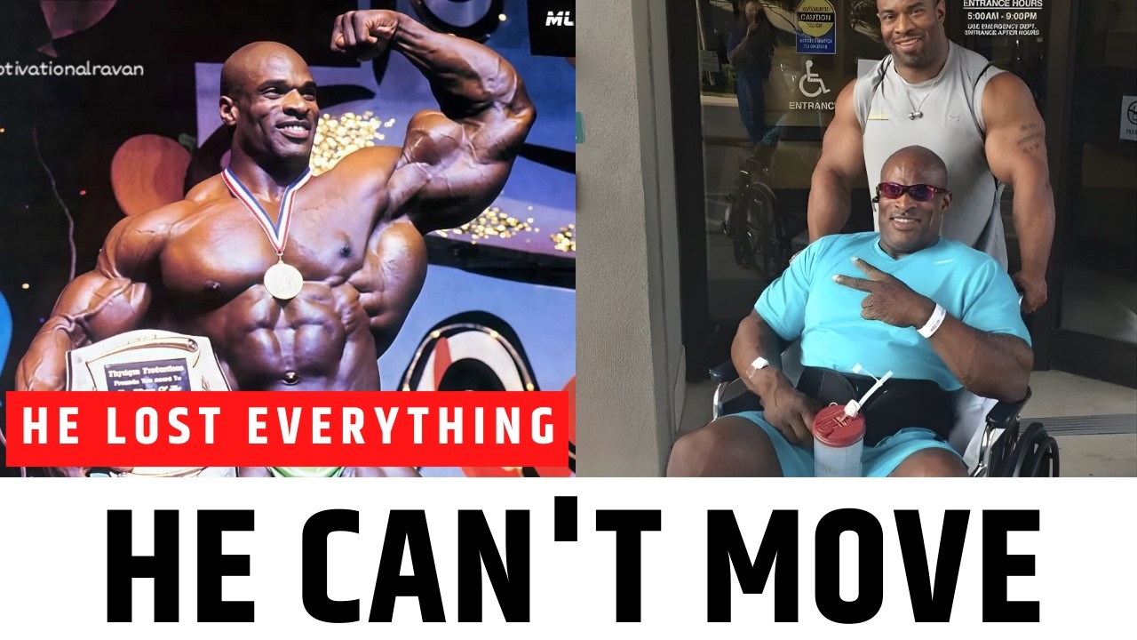 30 Famous Bodybuilders Who Took It Too Far (Then vs Now) 😲