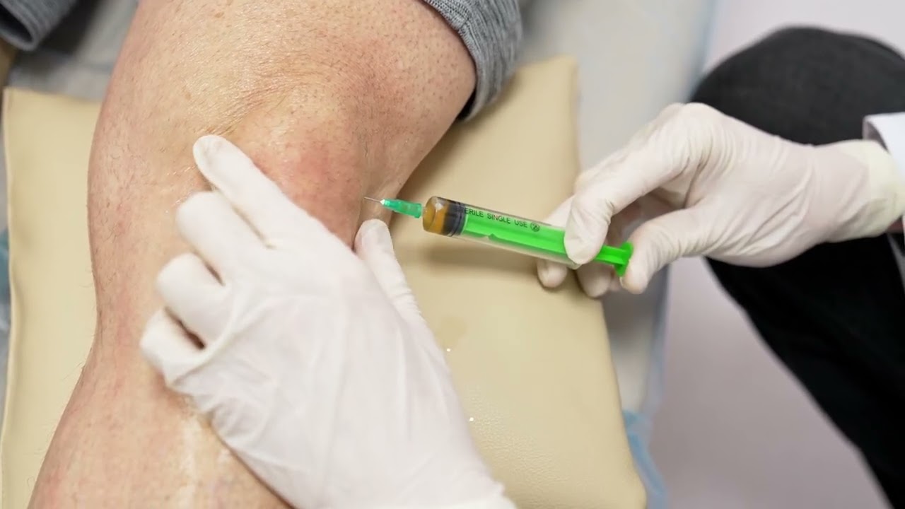 Prolotherapy