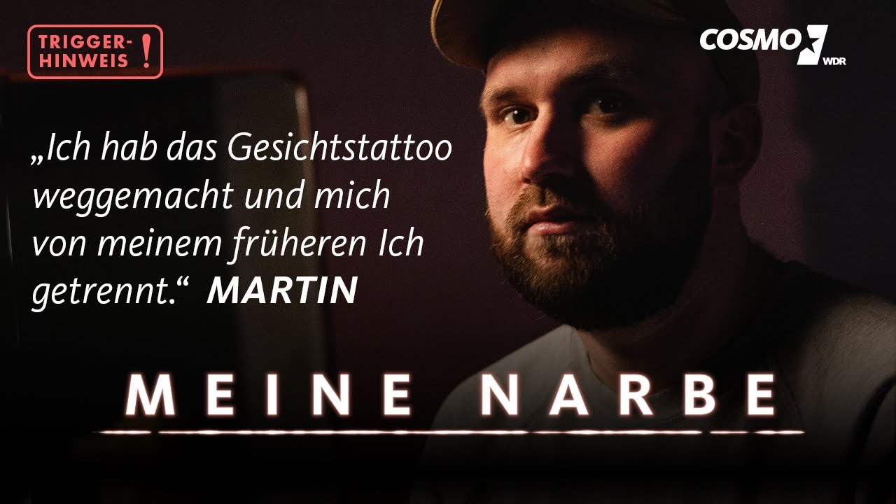 Martin war Häftling in einem syrischen Foltergefängnis | Meine Narbe | COSMO