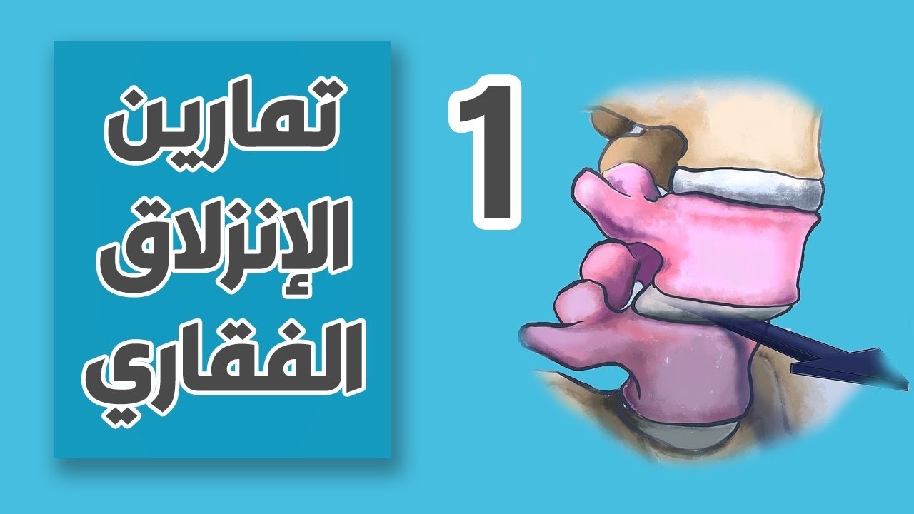 الإنزلاق الفقاري - تمارين علاجية المستوى الأول (اول أسبوعين)Spondylolisthesis Exercises Phase 1