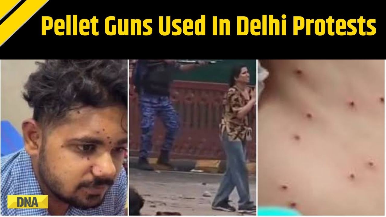 CJP Protest: Medical Papers Confirm Pellet Wounds At CJP Protest Despite Official Denials