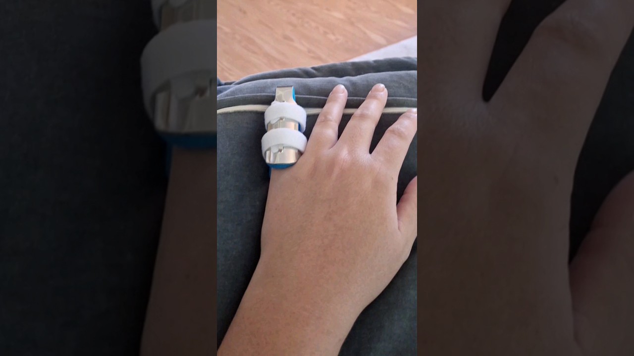 I broke my pinky! You won't believe how! HAVE YOU EVER 🙄